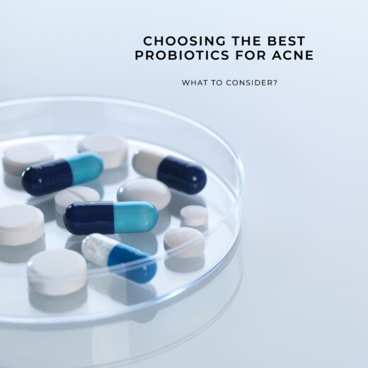 Image of probiotics supplements on a tray. Titled "Choosing the Best Probiotics for Acne" and what to consider?